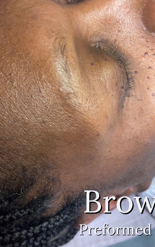 Before Image: Brow Tint - front