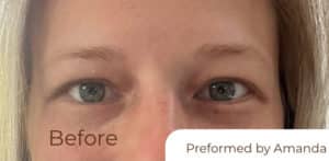 Before Image: Brow and Lash Tint