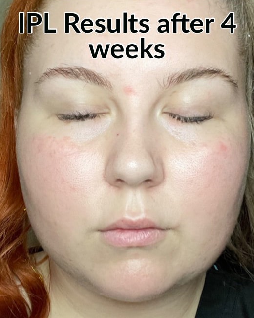 After Image: IPL - front