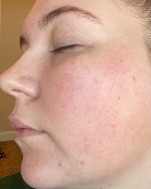 Before Image: IPL - left-front-oblique