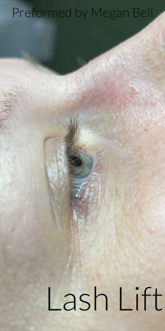 Before Image: Lash Lift and Tint - front