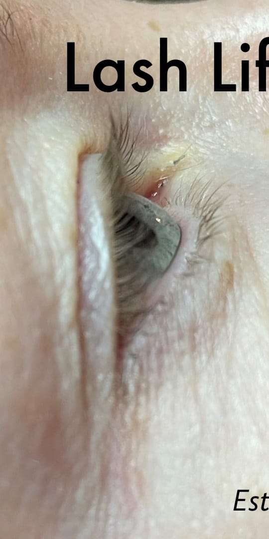 Before Image: Lash Lift and Tint - front