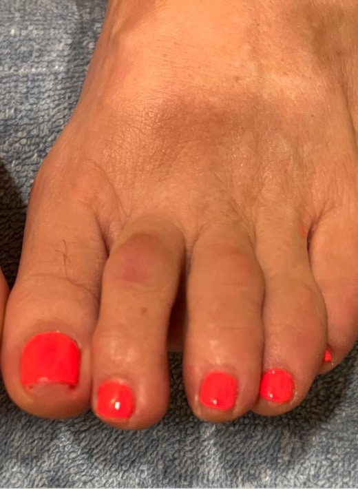 After Image: Nails - front