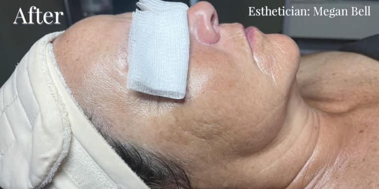 After Image: Signature Facial - front