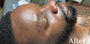 After Image: Signature Facial