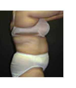 After Image: Transion – Case 3 - other