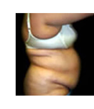 Before Image: Transion – Case 3 - other