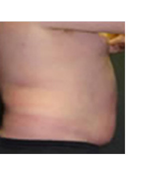 After Image: Transion – Case 4 - other